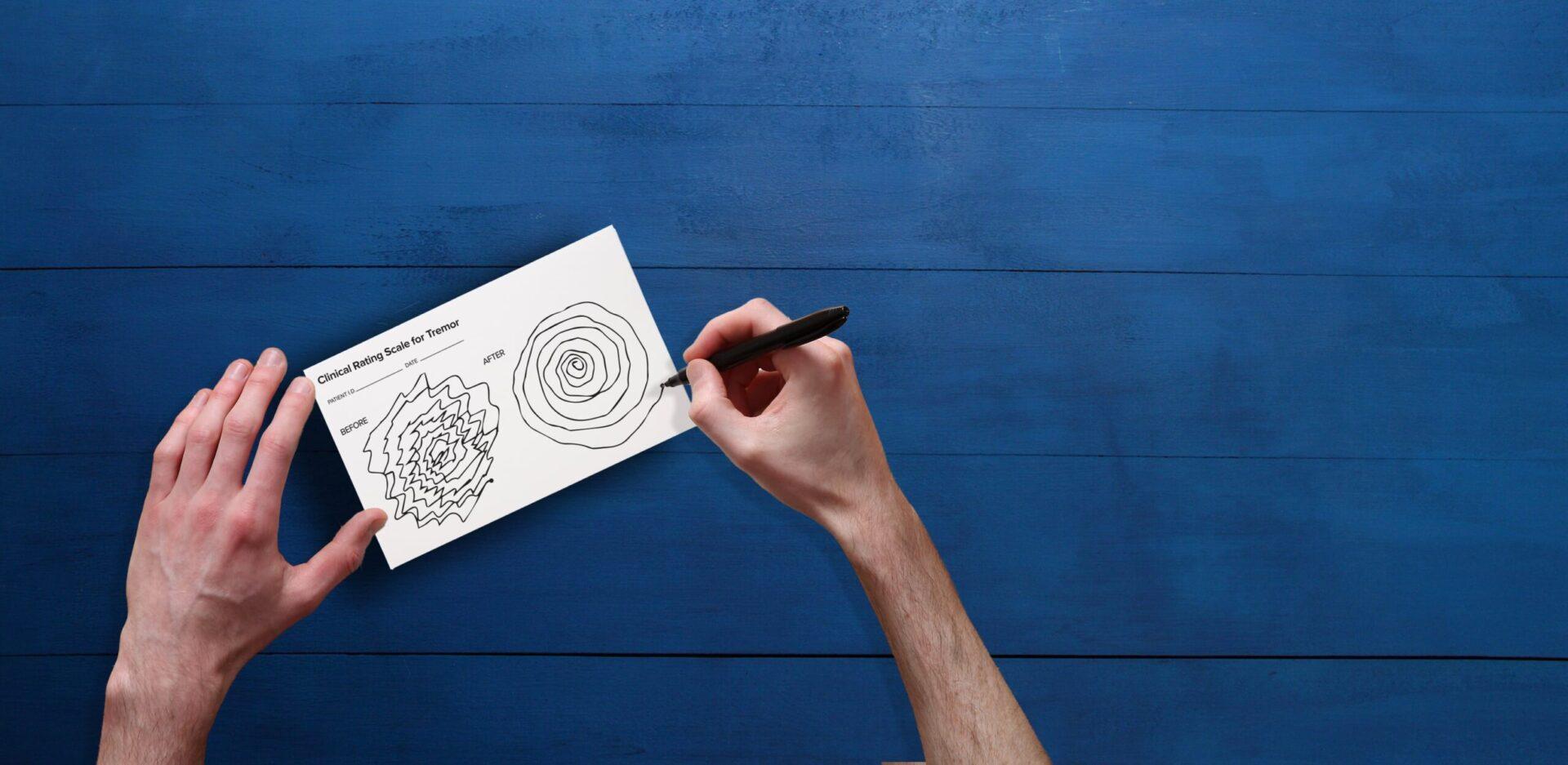 A hand drawing the Archimedes spiral on a Clinical Rating Scale for Tremor form, showing a jagged &ldquo;before&rdquo; spiral beside a smooth &ldquo;after&rdquo; spiral